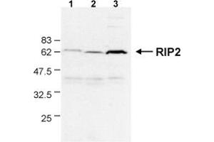 Detection of endogenous human RIP2 in different human cell lines by the MAb to RIP2 (Nick-1) .