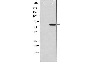 Western blot analysis of CDC25A expression in UV treated A2780 whole cell lysates,The lane on the left is treated with the antigen-specific peptide. (CDC25A 抗体  (N-Term))