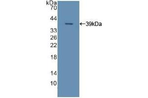 Detection of Recombinant APOC2, Human using Polyclonal Antibody to Apolipoprotein C2 (APOC2)