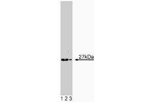 Western blot analysis of Syntaxin 8 on human cell endothelial lysate. (STX8 抗体  (AA 57-164))