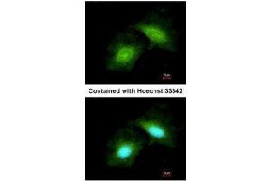 ICC/IF Image Immunofluorescence analysis of methanol-fixed HeLa, using GADD45 gamma, antibody at 1:200 dilution. (GADD45G 抗体  (C-Term))