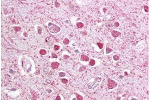 Anti-CEBPG / CEBP Gamma antibody IHC staining of human brain, cortex. (CEBPG 抗体  (AA 139-150))
