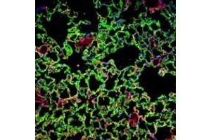Bleomycin-induced lung injury in WT mice: Confocal images of untreated and bleomycin-treated WT lung stained with antibodies against PDGFRβ and RAGE to illustrate fibrotic foci at sites of epithelial damage. (RAGE 抗体  (Extracellular Domain))