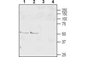 Western blot analysis of mouse (lanes 1 and 3) and rat (lanes 2 and 4) brain lysate: - 1,2. (SLC1A6 抗体  (2nd Extracellular Loop))