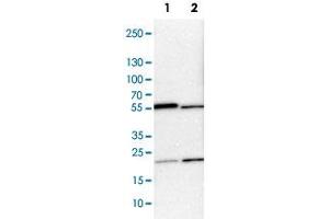 Western Blot analysis of Lane 1: NIH-3T3 cell lysate (mouse embryonic fibroblast cells) and Lane 2: NBT-II cell lysate (Wistar rat bladder tumor cells) with ARHGAP1 polyclonal antibody . (ARHGAP1 抗体)