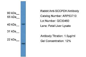 WB Suggested Anti-SCCPDH  Antibody Titration: 0. (SCCPDH 抗体  (Middle Region))