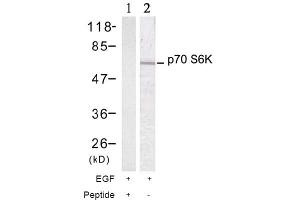 Image no. 2 for anti-Ribosomal Protein S6 Kinase, 70kDa, Polypeptide 1 (RPS6KB1) (Thr389) antibody (ABIN197397) (RPS6KB1 抗体  (Thr389))
