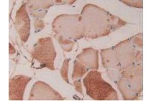 IHC-P analysis of Rat Skeletal Muscle Tissue, with DAB staining. (Fibrillin 1 抗体  (AA 751-895))