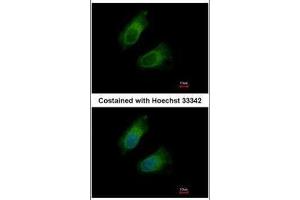 ICC/IF Image Immunofluorescence analysis of methanol-fixed HeLa, using GOT2, antibody at 1:500 dilution. (GOT2 抗体  (Center))