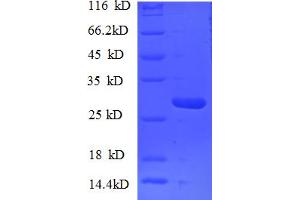 NUP153 Protein (AA 657-880) (His tag)