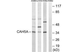 Western Blotting (WB) image for anti-Carbonic Anhydrase VA (CA5A) (Internal Region) antibody (ABIN1851008) (CA5A 抗体  (Internal Region))