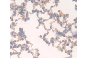 Used in DAB staining on fromalin fixed paraffin- embedded Kidney tissue (FLT1 抗体  (AA 18-308))