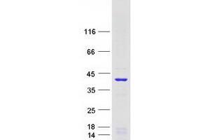Western Blotting (WB) image for GTP Binding Protein Overexpressed in Skeletal Muscle (GEM) (Transcript Variant 1) protein (Myc-DYKDDDDK Tag) (ABIN2721789)