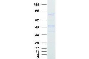 Western Blotting (WB) image for SUZ12 Polycomb Repressive Complex 2 Subunit (SUZ12) protein (Myc-DYKDDDDK Tag) (ABIN2733019)