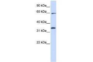 WB Suggested Anti-RHOT1 Antibody Titration:  0. (RHOT1 抗体  (Middle Region))