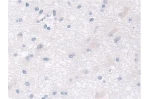 #VALUE! (MPI 抗体  (AA 2-423))