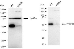 Western blotting analysis using PFKFB3 antibody (ABIN7797431).
