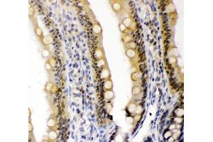 IHC analysis of CRY1 using anti-CRY1 antibody (ABIN3042761).