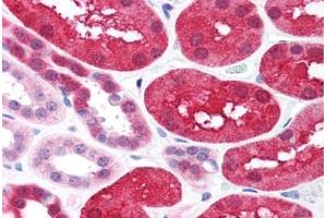 Human Kidney (formalin-fixed, paraffin-embedded) stained with XIAP antibody ABIN214586 at 2 ug/ml followed by biotinylated goat anti-rabbit IgG secondary antibody ABIN481713, alkaline phosphatase-streptavidin and chromogen. (XIAP 抗体  (C-Term))