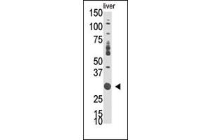 Western Blotting (WB) image for anti-Docking Protein 5 (DOK5) (N-Term) antibody (ABIN359962) (DOK5 抗体  (N-Term))