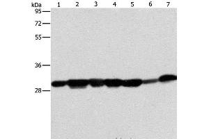 Western Blot analysis of Human placenta tissue and A549 cell, Mouse brain tissue and hepG2 cell, Raji cell and Human fetal liver tissue, hela cell using AK2 Polyclonal Antibody at dilution of 1:300 (Adenylate Kinase 2 抗体)
