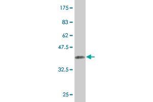 Western Blot detection against Immunogen (36. (KAT2A 抗体  (AA 738-837))