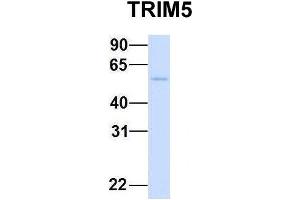 Host:  Rabbit  Target Name:  CHAD  Sample Type:  Human Adult Placenta  Antibody Dilution:  1. (TRIM5 抗体  (N-Term))