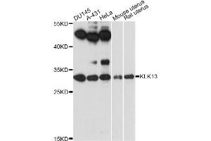 Western blot analysis of extracts of various cell lines, using KLK13 antibody (ABIN6293043) at 1:3000 dilution. (Kallikrein 13 抗体)