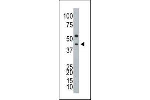 Image no. 1 for anti-Ataxin 3 (ATXN3) (N-Term) antibody (ABIN357621) (Ataxin 3 抗体  (N-Term))