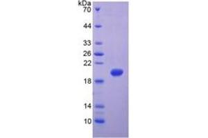 SDS-PAGE of Protein Standard from the Kit (Highly purified E. (MMP 9 ELISA 试剂盒)