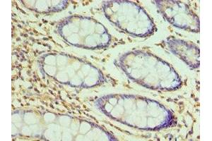 Immunohistochemistry of paraffin-embedded human colon tissue using ABIN7155385 at dilution of 1:100 (H2AFZ 抗体  (AA 1-128))