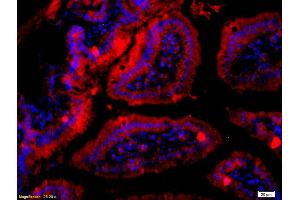 Formalin-fixed and paraffin embedded mouse intestine labeled with Anti- RET Polyclonal Antibody, Unconjugated (ABIN680788) at 1:200 followed by conjugation to the secondary antibody Goat Anti-Rabbit IgG, Cy3 conjugated used at 1:200 dilution for 40 minutes at 37°C and DAPI staining (Ret Proto-Oncogene 抗体  (AA 1001-1114))