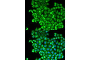 Immunofluorescence analysis of A549 cell using LDHA antibody. (Lactate Dehydrogenase A 抗体  (AA 1-332))