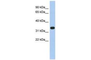 Image no. 1 for anti-Sulfotransferase Family 1B Member 1 (SULT1B1) (N-Term) antibody (ABIN6743488)