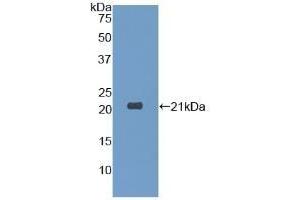 Detection of Recombinant DPT, Human using Polyclonal Antibody to Dermatopontin (DPT) (Dermatopontin 抗体  (AA 26-197))