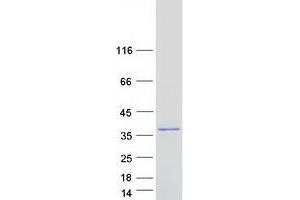 Western Blotting (WB) image for Nebulette (NEBL) (Transcript Variant 2) protein (Myc-DYKDDDDK Tag) (ABIN2727047)