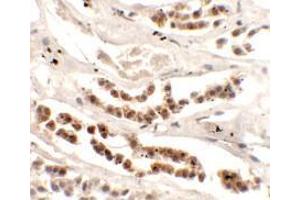 Immunohistochemistry of DISP1 in human kidney tissue with DISP1 Antibody (N-term) at 2. (DISP1 抗体  (N-Term))