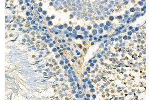 ABIN7093914 and ABIN7097958 at 1/100 staining Rat kidney tissue by IHC-P.