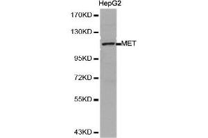 Western Blotting (WB) image for anti-Met Proto-Oncogene (MET) (AA 25-325) antibody (ABIN1513199) (c-MET 抗体  (AA 25-325))
