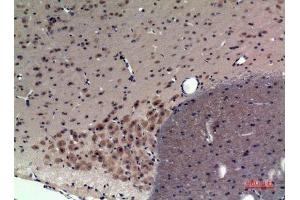 Immunohistochemistry (IHC) analysis of paraffin-embedded Rat Brain, antibody was diluted at 1:100.