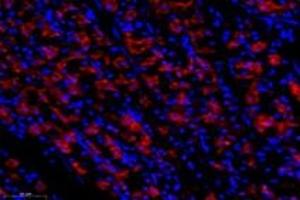 Immunofluorescent analysis of paraformaldehyde-fixed human stomach using Epsin-3 (ABIN7073856) at dilution of 1: 1400 (EPN3 抗体)