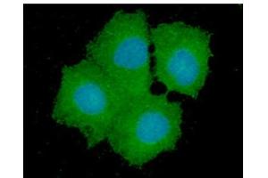 ICC/IF analysis of GPD1L in Hep3B cells line, stained with DAPI (Blue) for nucleus staining and monoclonal anti-human GPD1L antibody (1:100) with goat anti-mouse IgG-Alexa fluor 488 conjugate (Green). (GPD1L 抗体)