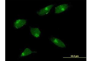 Immunofluorescence of purified MaxPab antibody to MGAT1 on HeLa cell. (MGAT1 抗体  (AA 1-445))