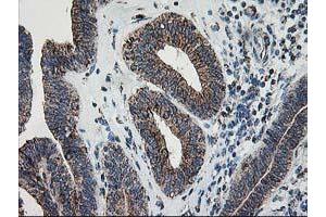 Image no. 3 for anti-Dihydrolipoamide Dehydrogenase (DLD) antibody (ABIN1497845) (DLD 抗体)