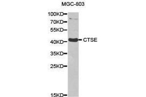 Western Blotting (WB) image for anti-Cathepsin E (CTSE) antibody (ABIN1872100) (Cathepsin E 抗体)
