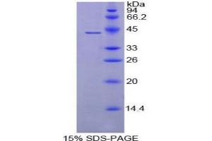SDS-PAGE analysis of Mouse C8b Protein. (C8B 蛋白)