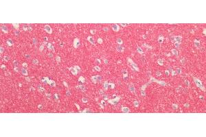 Detection of SYN1 in Human Cortex Tissue using Polyclonal Antibody to Synapsin I (SYN1) (SYN1 抗体  (AA 113-420))