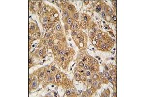 Immunohistochemistry (Paraffin-embedded Sections) (IHC (p)) image for anti-Apolipoprotein E (APOE) (C-Term) antibody (ABIN359760)