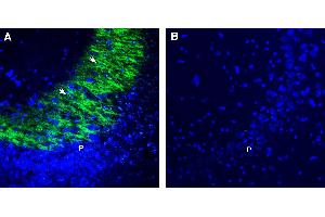 Expression of GPR31 in rat hippocampus. (GPR31 抗体  (Extracellular))