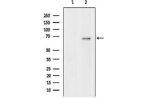 anti-Deltex Homolog 4 (Drosophila) (DTX4) (Internal Region) antibody